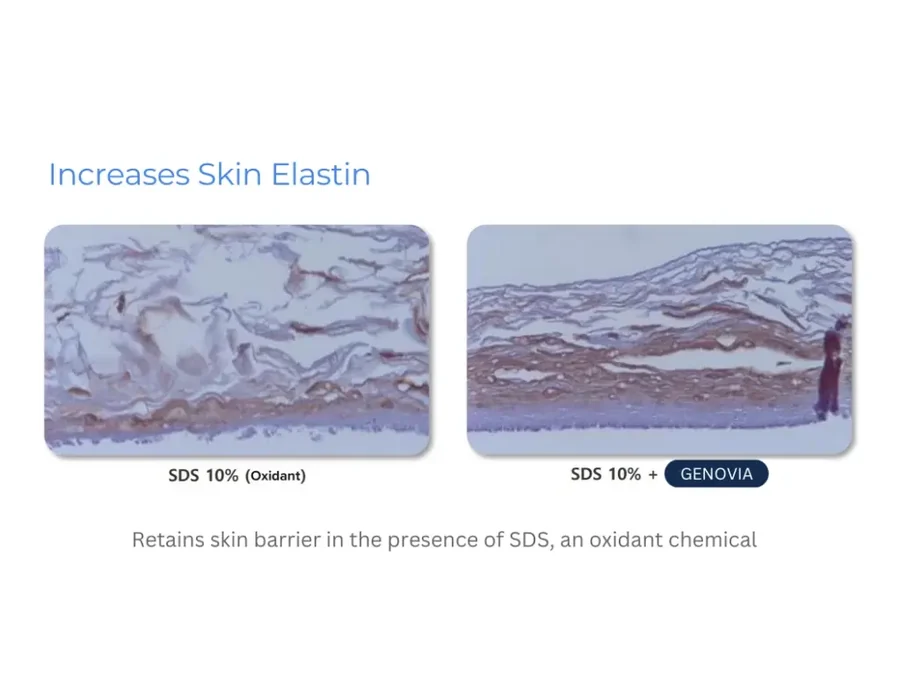 Genovia in-vitro laboratory data: skin elastin retention